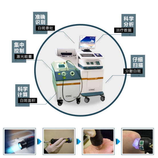 南通节段型白癜风出现的病因是什么